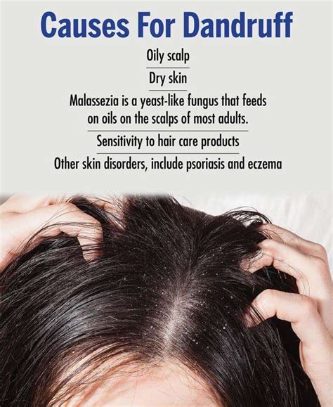 What Causes Dandruff In Relaxed Hair